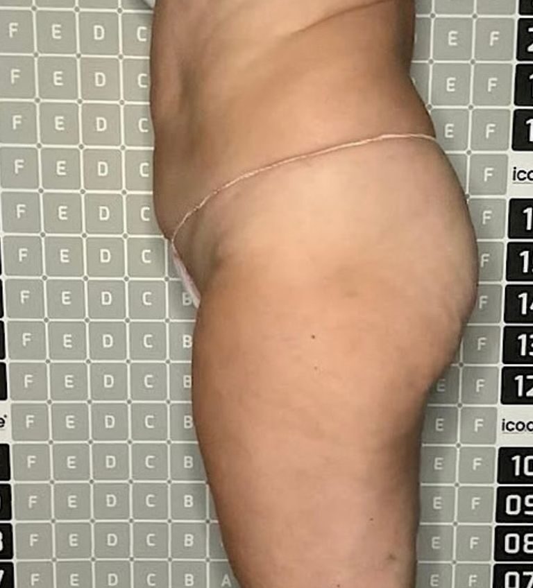 227