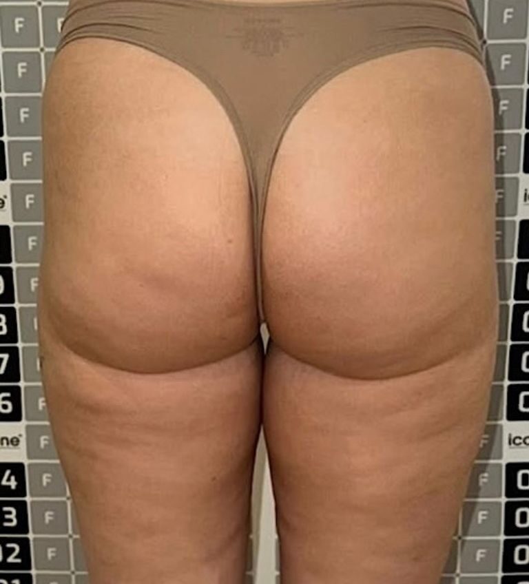 228
