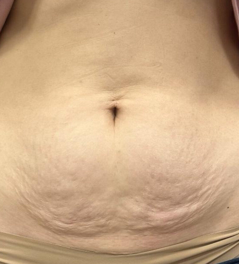 52