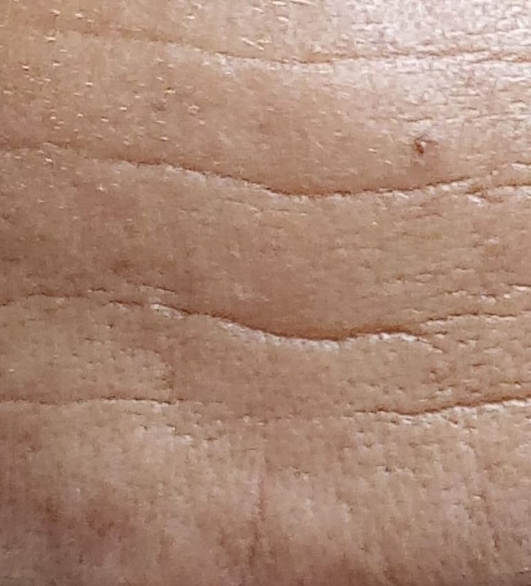 70