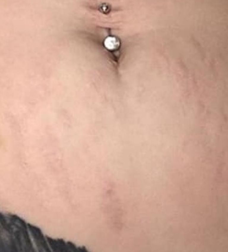 75