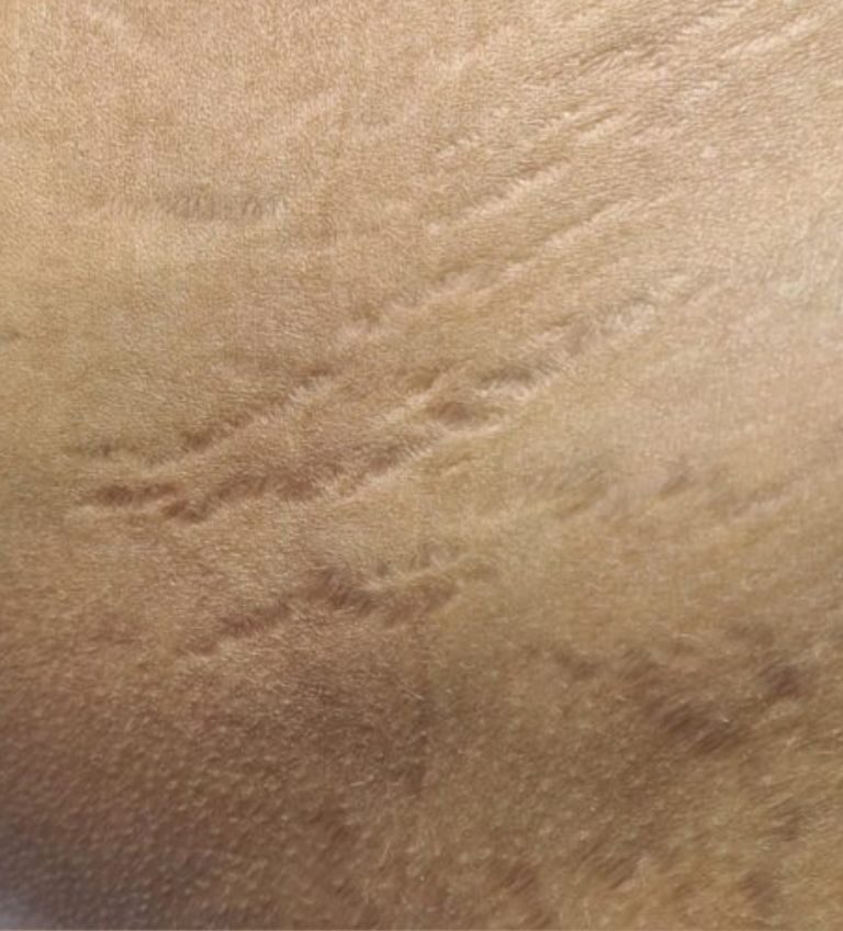 78