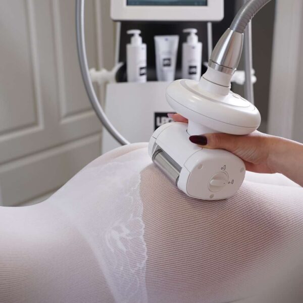 Endermologia LPG Alliance®