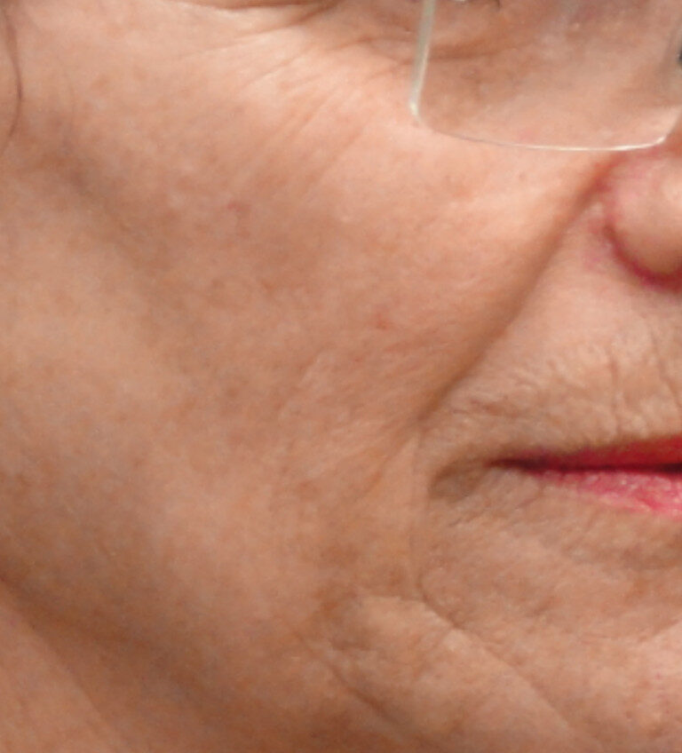 110