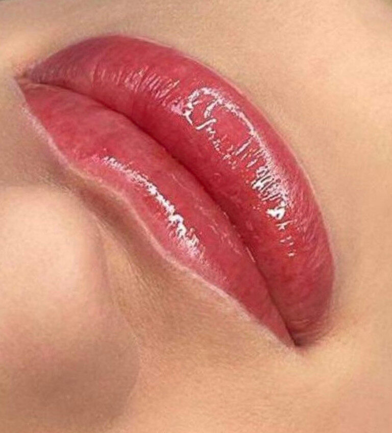 178