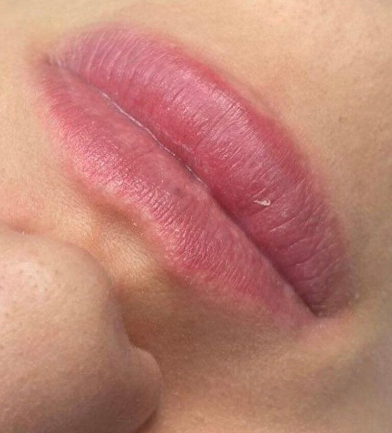 179