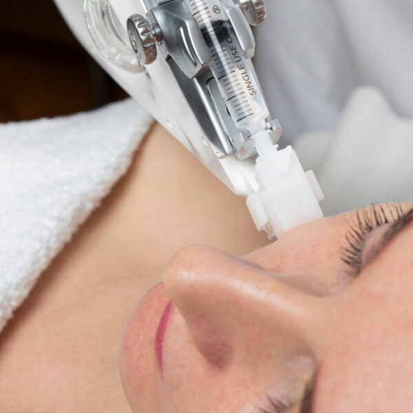 Mezoterapia próżniowa Vital Injector 2